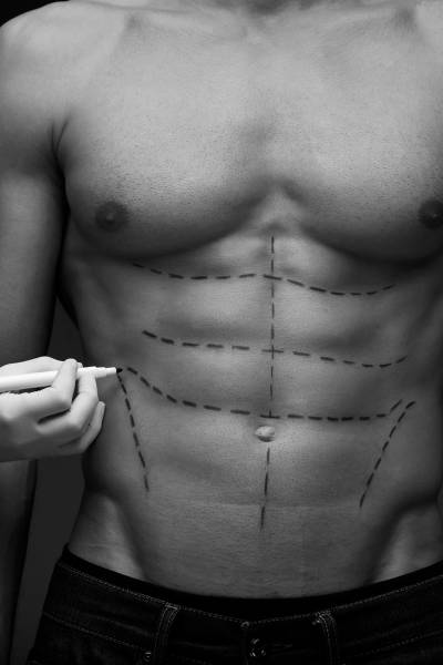 CHIRURGIE ESTHETIQUE DE L’HOMME